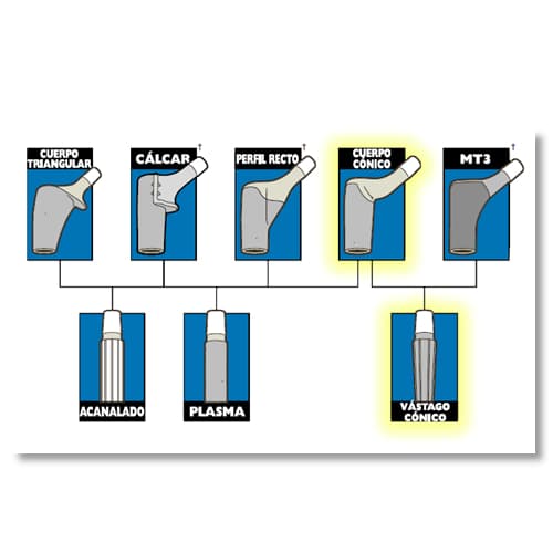 Sistemas de Revisión de Cadera