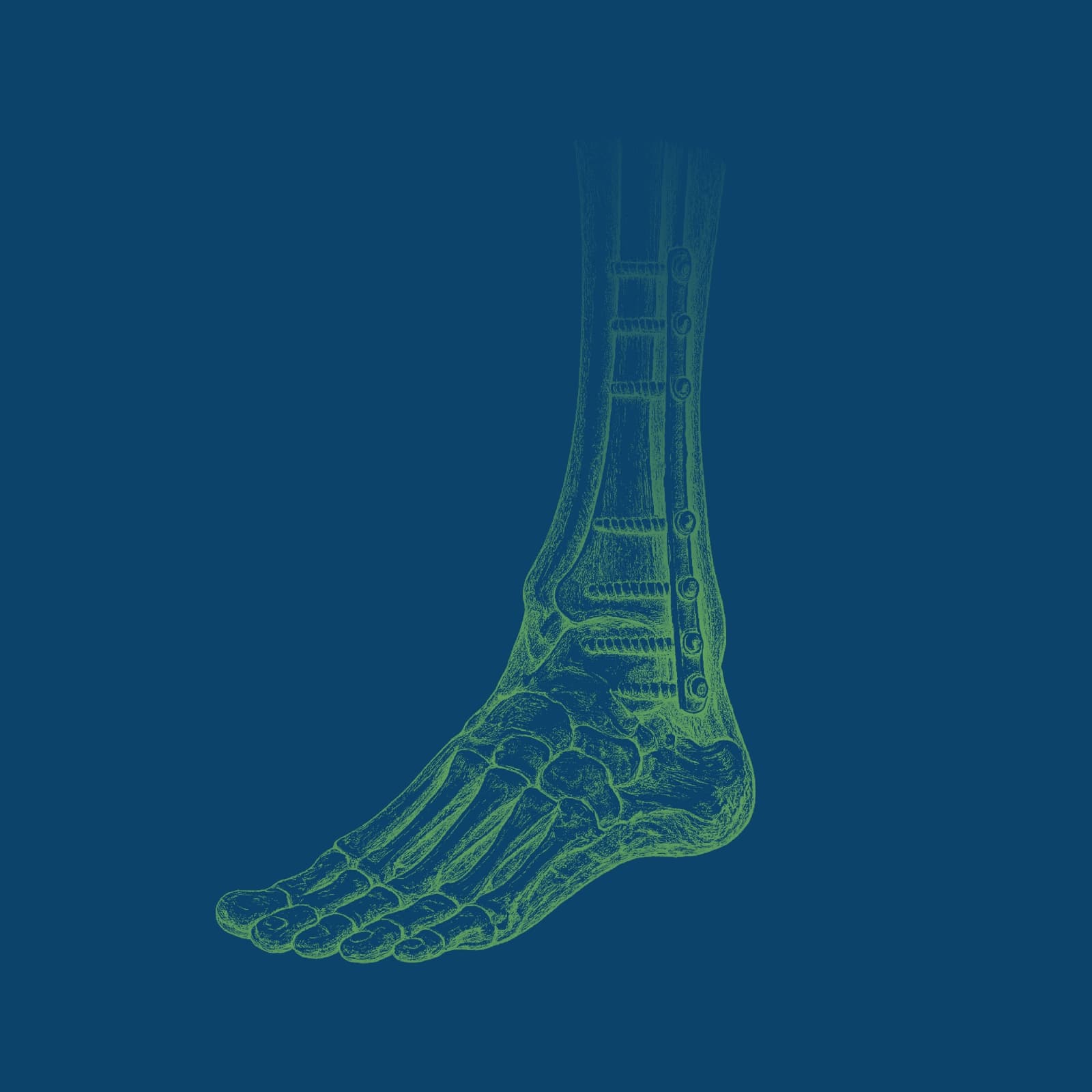 Osteosynthesis